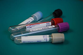 detailní, fotografie, čtyři, Průhledná, skleněné nádoby, selektivní, Pět, kontejnery, laboratoř, lékařský, diagnostika