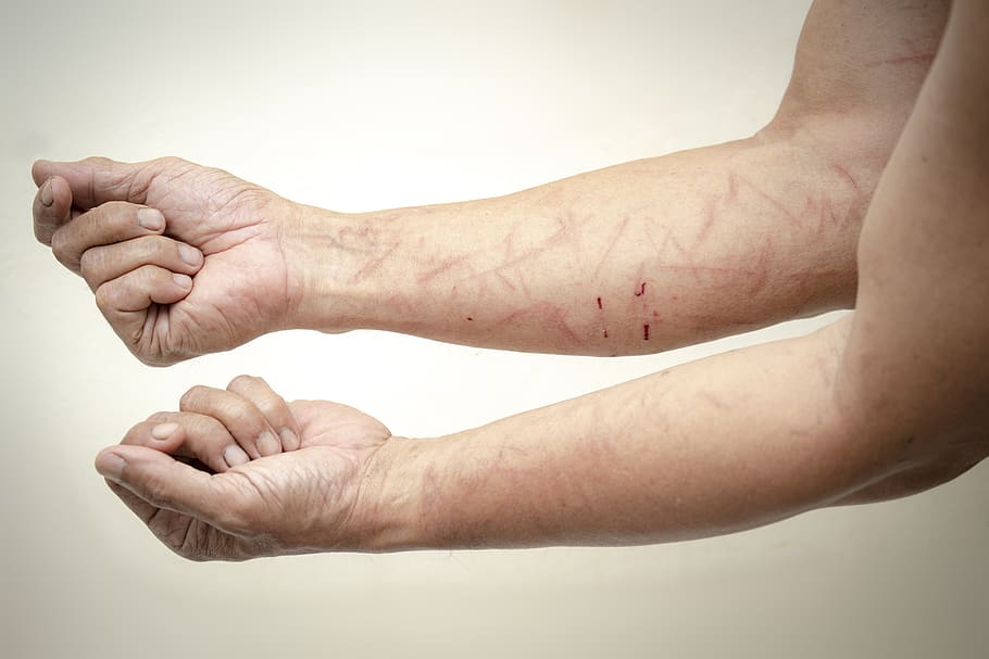 injury, arm, accident, doctor, orthopedic, patient, hospital, hurt, claim, anatomy, medical