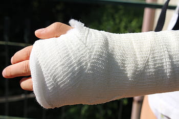 injury, orthopedics, chalk, bandage, care, accident, doctor, bandages, fracture, hand, forearm
