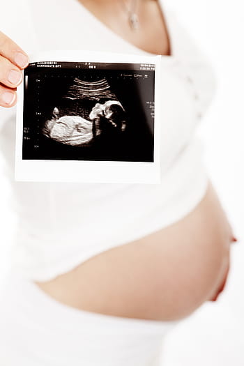 person, holding, ultrasound paper, baby, belly, body, child, expectant, female, health, maternity