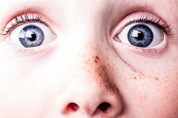 condición de la piel humana, sorprendido, ojos azules, pecas, ver, mirar, ojos, susto, cara, duro, personas