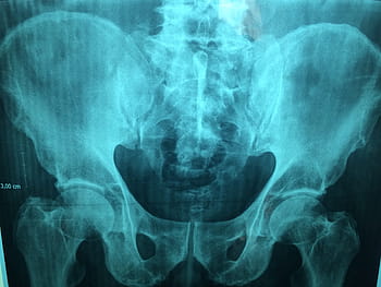 rentgenové ilustrace, lékař, x, x ray, nemocnice, lékař, skenovat, doktor, film, zkouška, diagnóza, kost
