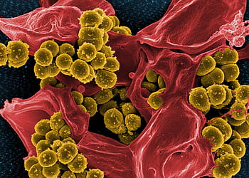 microscopic, photograph, bacteria, electron microscope, stained, green, staphylococcus aureus, spheroid, methicillin resistant, mrsa, bacterium