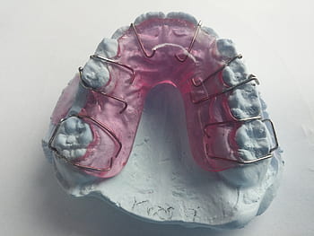 dentist, orthodontics, dental rail, rails, dental braces, tooth, dental brace, close up, mouth, bite, head
