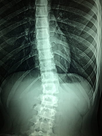 x-rays-hospital-disability-doctor-royalty-free-thumbnail.jpg