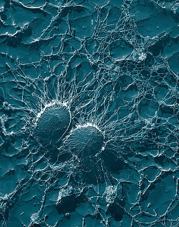 teal, white, decor, bacteria, cocci, staphylococci, staphylococcus, pathogens, disease, electron microscopy, electron micrograph