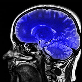 CT vyšetření, člověk, mozek, hlava, magnetická rezonance, mr T, x ray, x ray image, modrý, anatomie, lékařské prohlídky