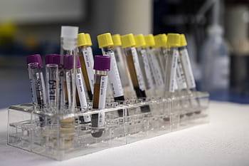 血液、 分析、 実験室、 テスト、 医療の、 健康、 診断医、 診断、 生化学、 ラボ、 サンプル