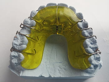 yellow, white, teeth brace molder, surface, dental braces, dentist, orthodontics, dental rail, seemed, tooth, dental brace