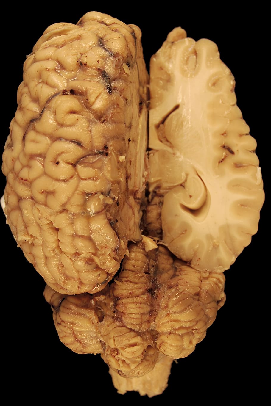 lidský mozek, mozek, anatomie, kůň, biologie, hřbetní, tělo, veterinární medicína, mozeček, polokoule, příčný řez