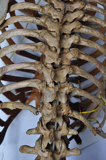 human, spinal, column, spinal column, bones, skeleton, back, spine, body, anatomy, medical