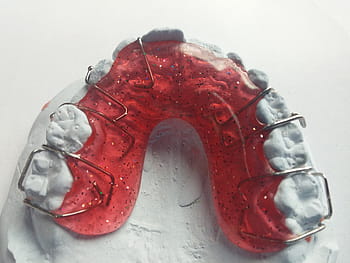 red, gray, teeth denture mold, dentist, orthodontics, dental rail, seemed, dental braces, tooth, dental brace, close