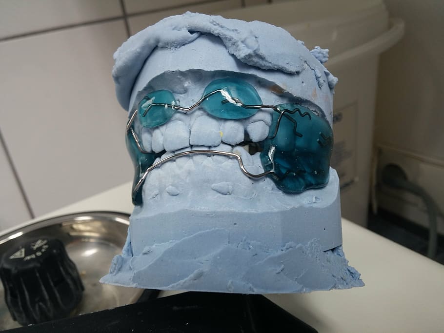 silver teeth braces, teeth mold, dentist, orthodontics, dental rail, seemed, dental braces, tooth, dental brace, close, mouth