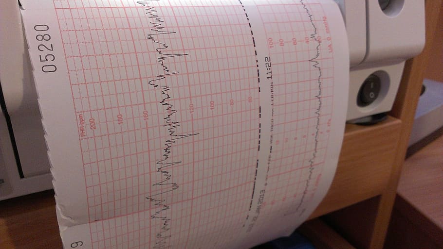 white, printer paper, brown, wooden, rack, doppler ultrasound, investigation, chart, evaluation, pregnant, pregnancy